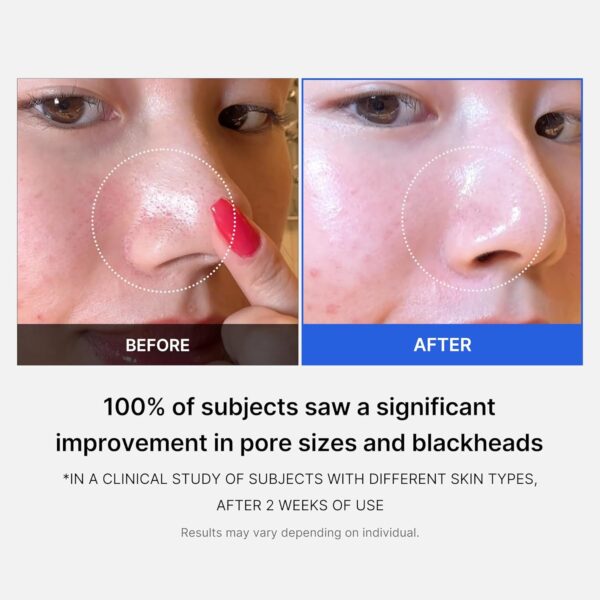 Medicube Zero Pore Pads 2.0, Dual-Textured Facial - Image 3