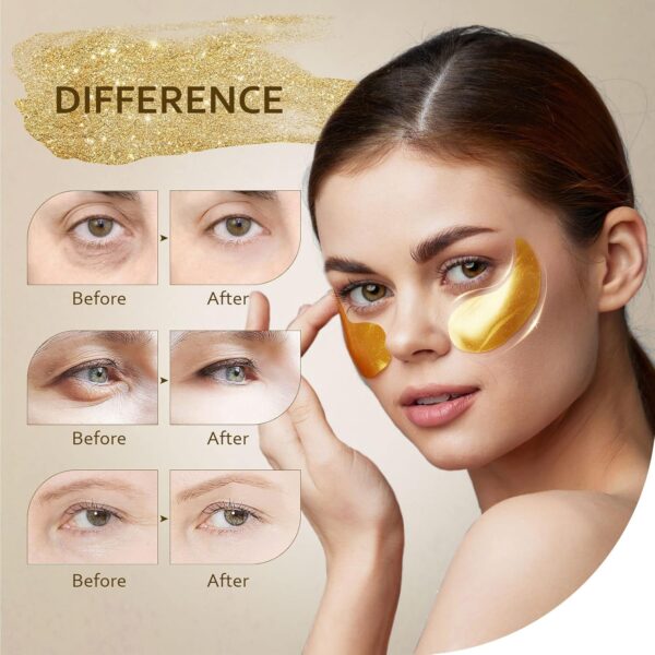 Under Eye Patches (30 Pairs), 24K Gold Under Eye Mask -50% - Image 2