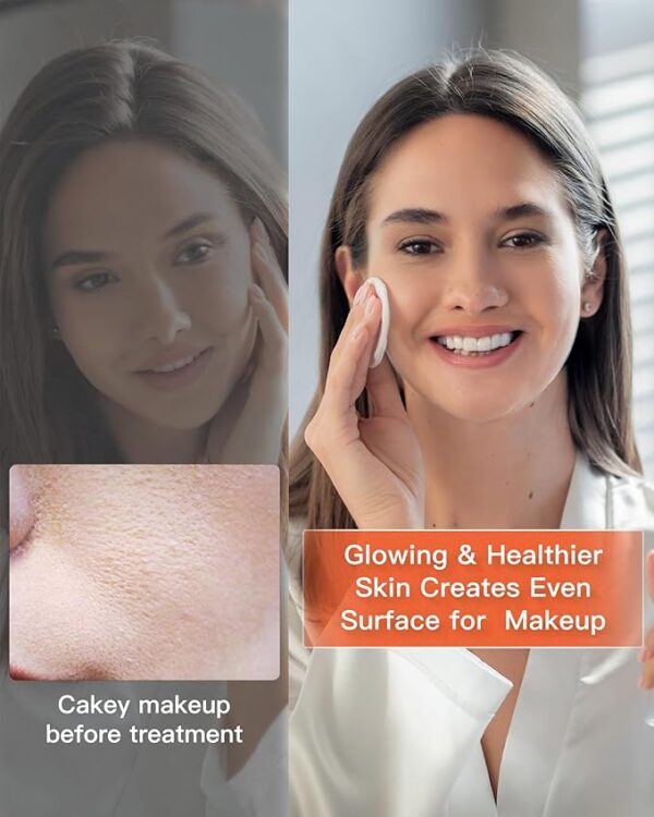 Face Mask Light Therapy,Red Light Therapy for Face Wrinkle Blue Light -15% $128.25 $128.25 per count($128.25 / count) Typical price: $150.89Typical price: $150.89 - Image 3